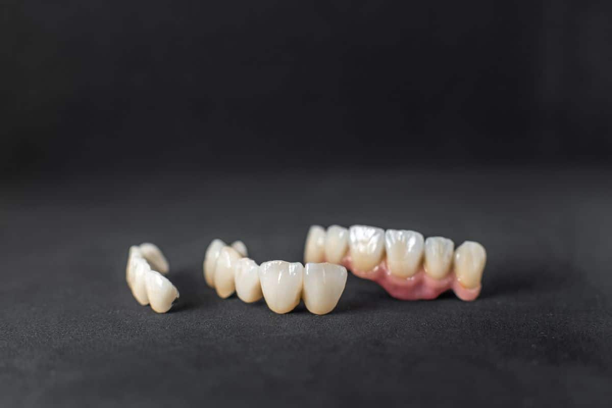 Why Should You Get A Dental Crown