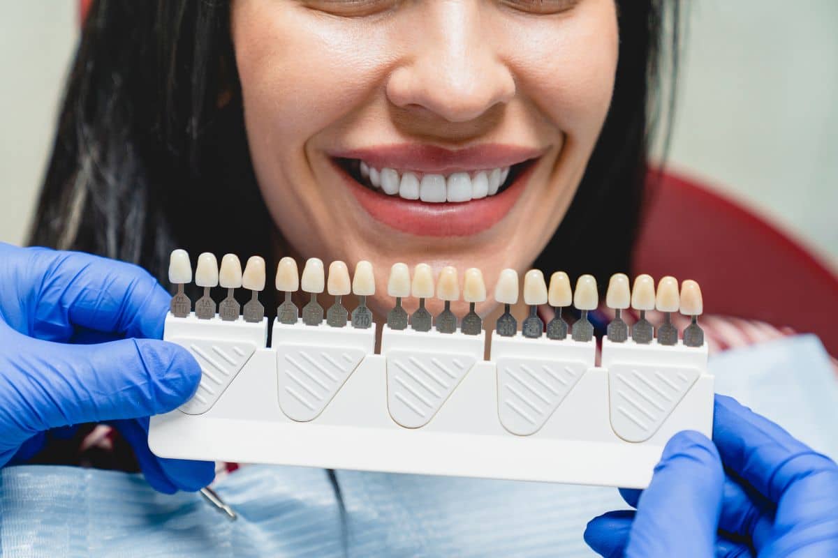 dentist holding veneers plate to female dental patients mouth