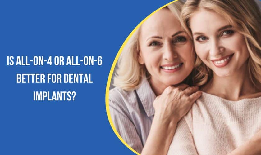 Is All-On-4 Or All-On-6 Better For Dental Implants?