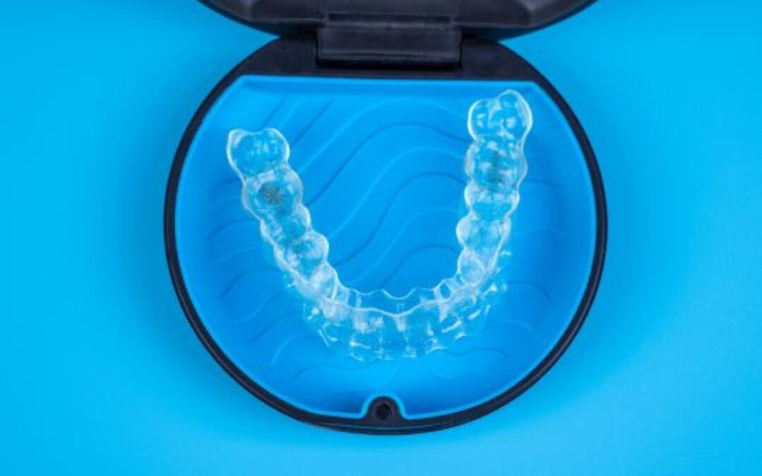 Smile, Discreetly: The Aesthetic Advantage of Invisalign Over Braces