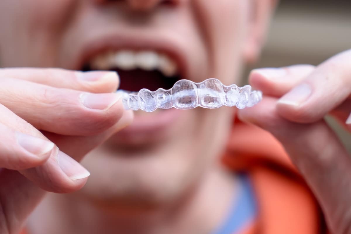 Invisalign Wearing at the dental office in Phoenix
