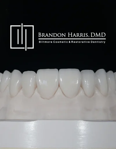 Dental Veneers Module at Biltmore Cosmetic & Restorative Dentistry Phoenix
