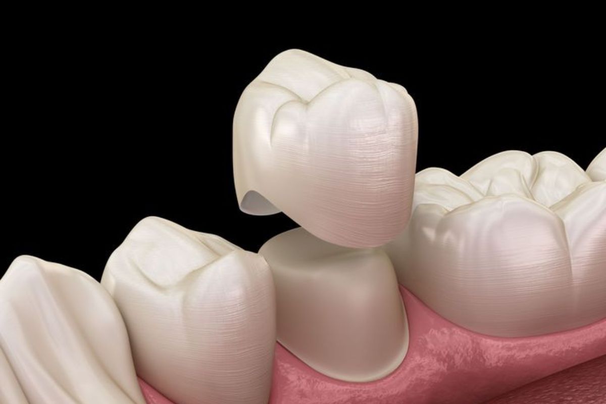 Restorative Dentist in Phoenix