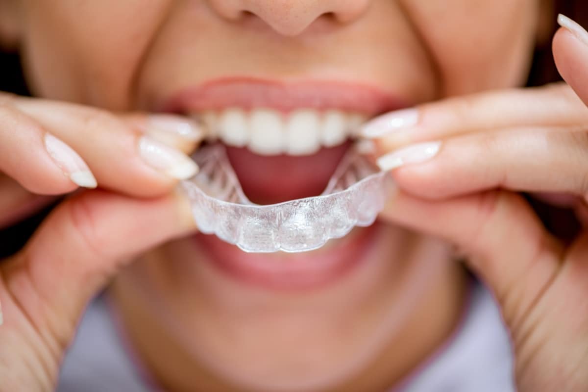 Choose Invisalign in Phoenix