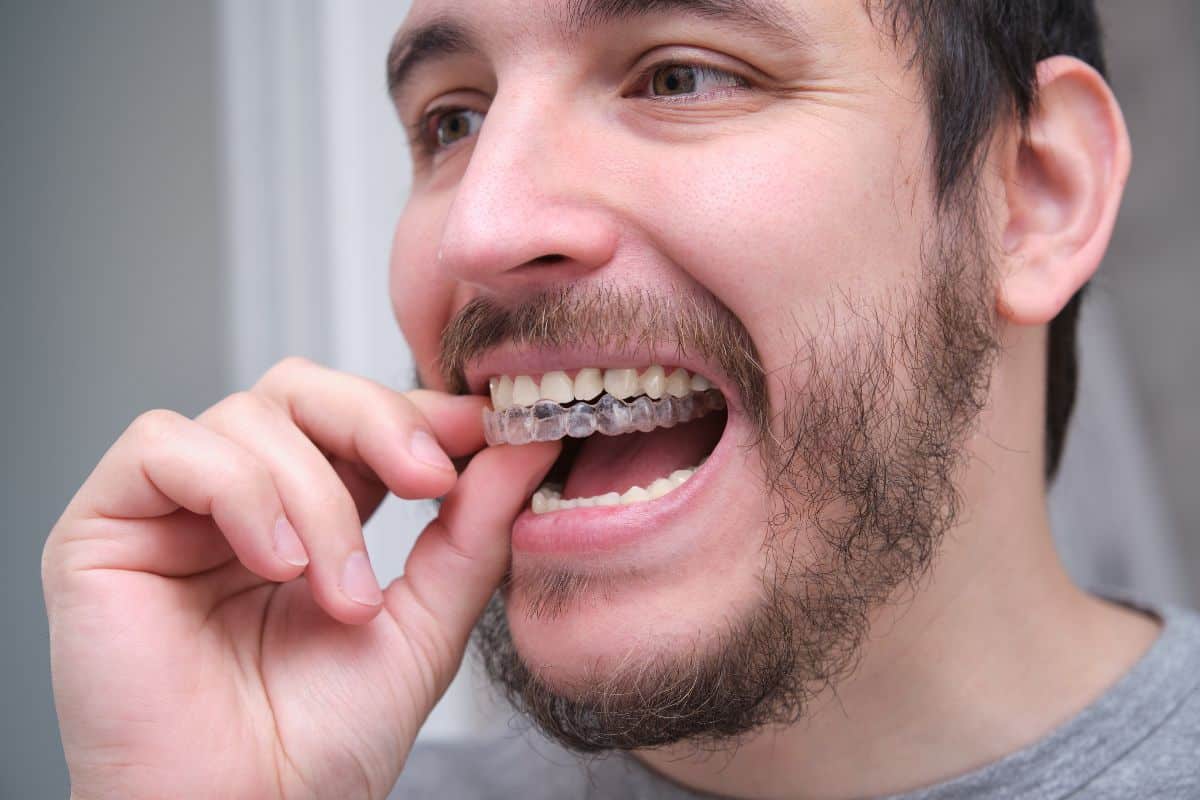 How Does Invisalign Work