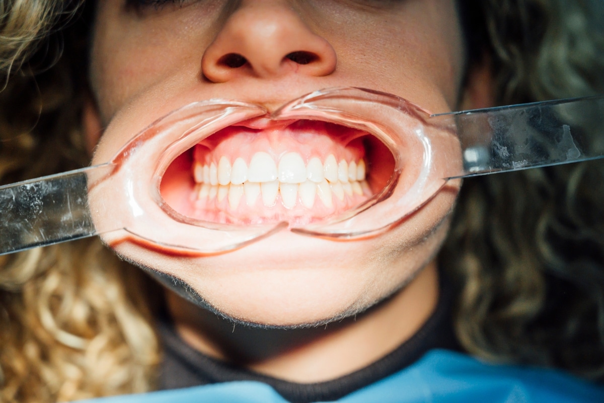 A Female Dental Patients Receiving Cosmetic Dentistry in Phoenix