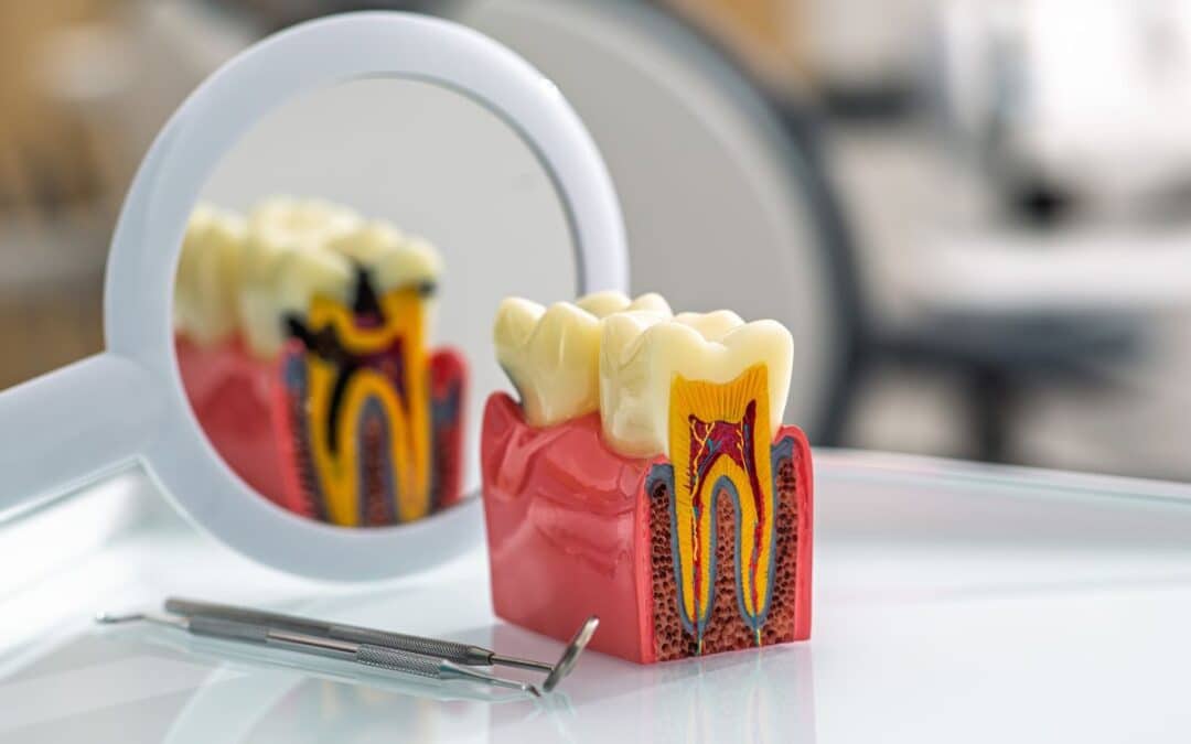 Is It Possible to Reverse Cavities? Here’s What Phoenix Locals Should Know