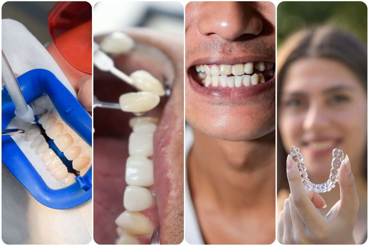 Cosmetic Dental Treatments in Phoenix at Biltmore Cosmetic