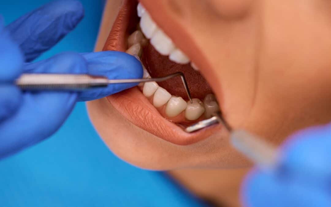 Maintaining Oral Health Between Visits To Your Phoenix Dental Expert