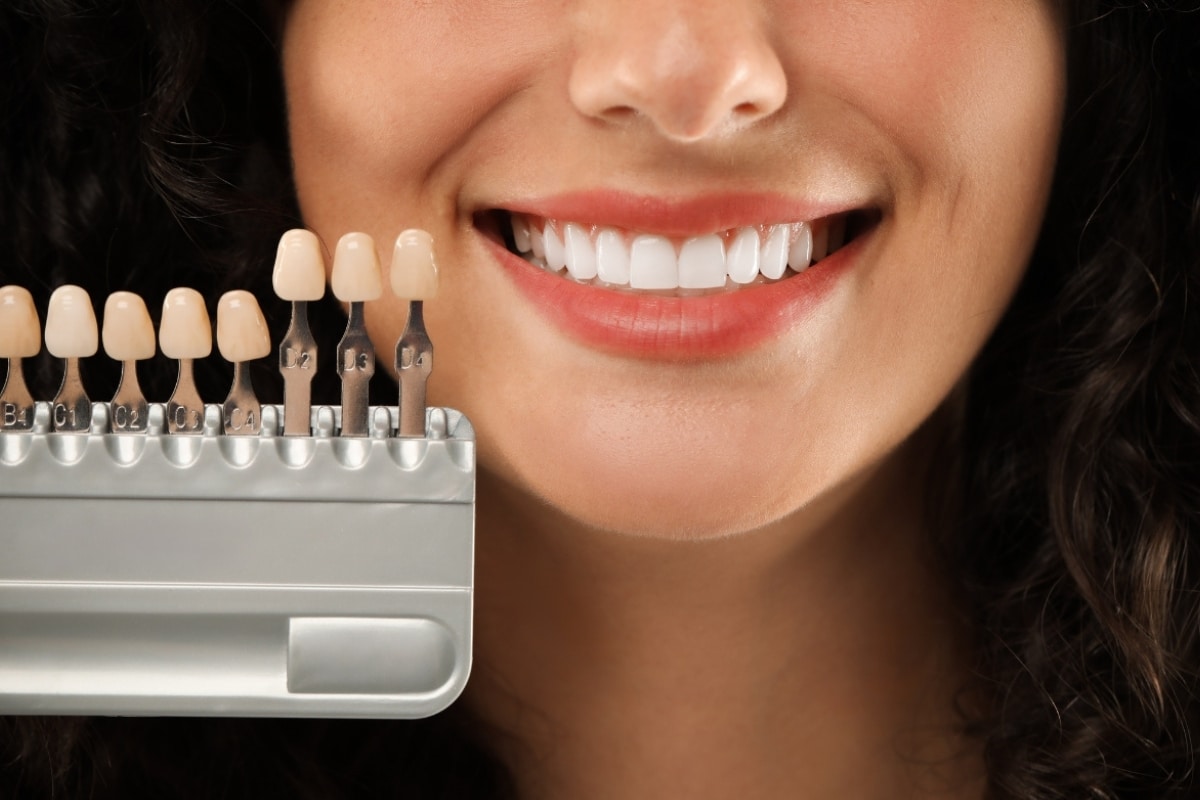 What Makes Veneers a Popular Cosmetic Dentistry Choice in Phoenix