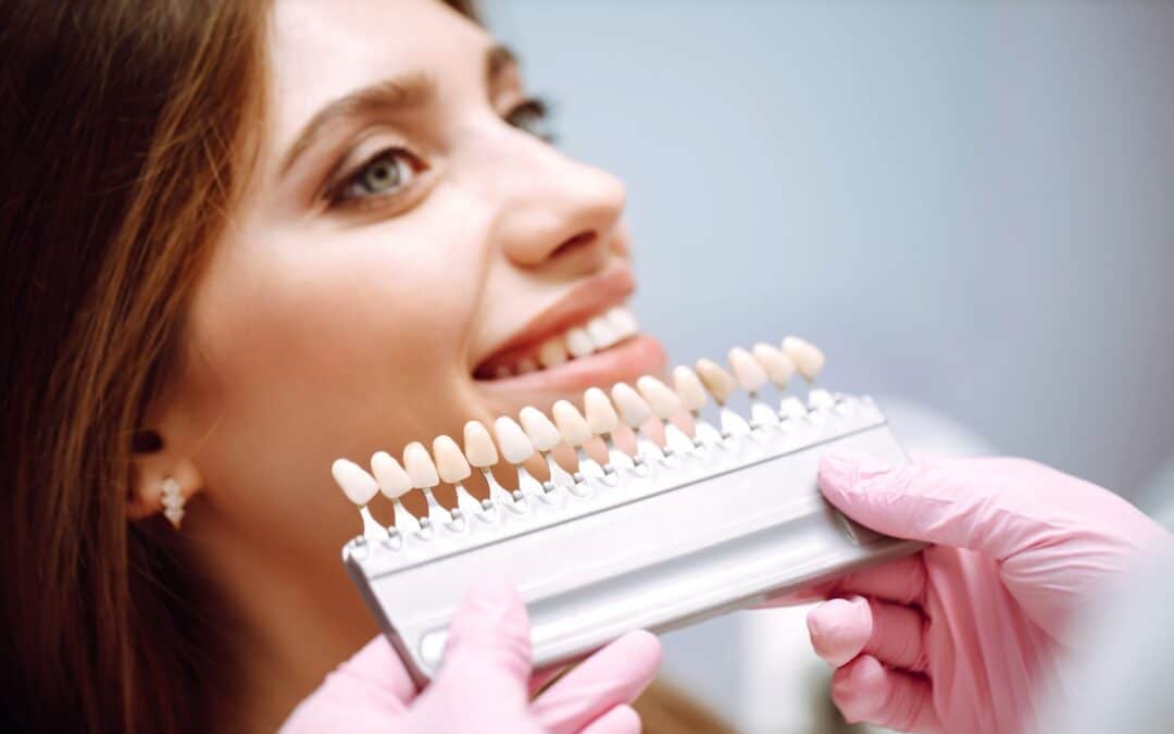 Is Your Veneer Loose? Here’s How to Address It Quickly