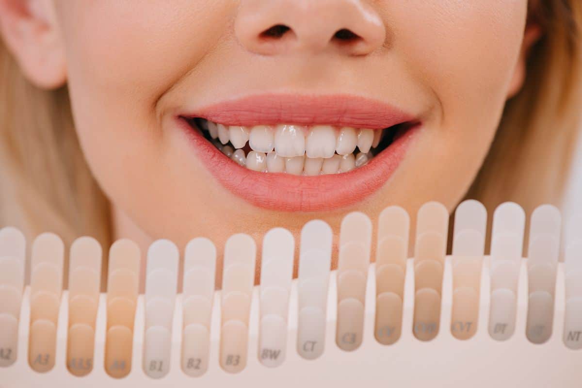 How Can an Oral Care Provider Reduce Whitening Sensitivity