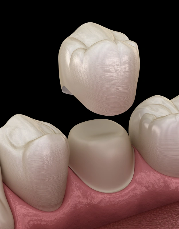 A 3D graphic showing a custom dental crown being placed over a prepared tooth, next to text about dental crown benefits at Biltmore Cosmetic & Restorative Dentistry.