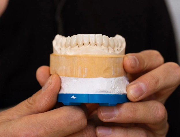 A close-up of a custom dental mold holding a set of porcelain veneers next to text describing a confident smile transformation at Biltmore Cosmetic & Restorative Dentistry in Phoenix.