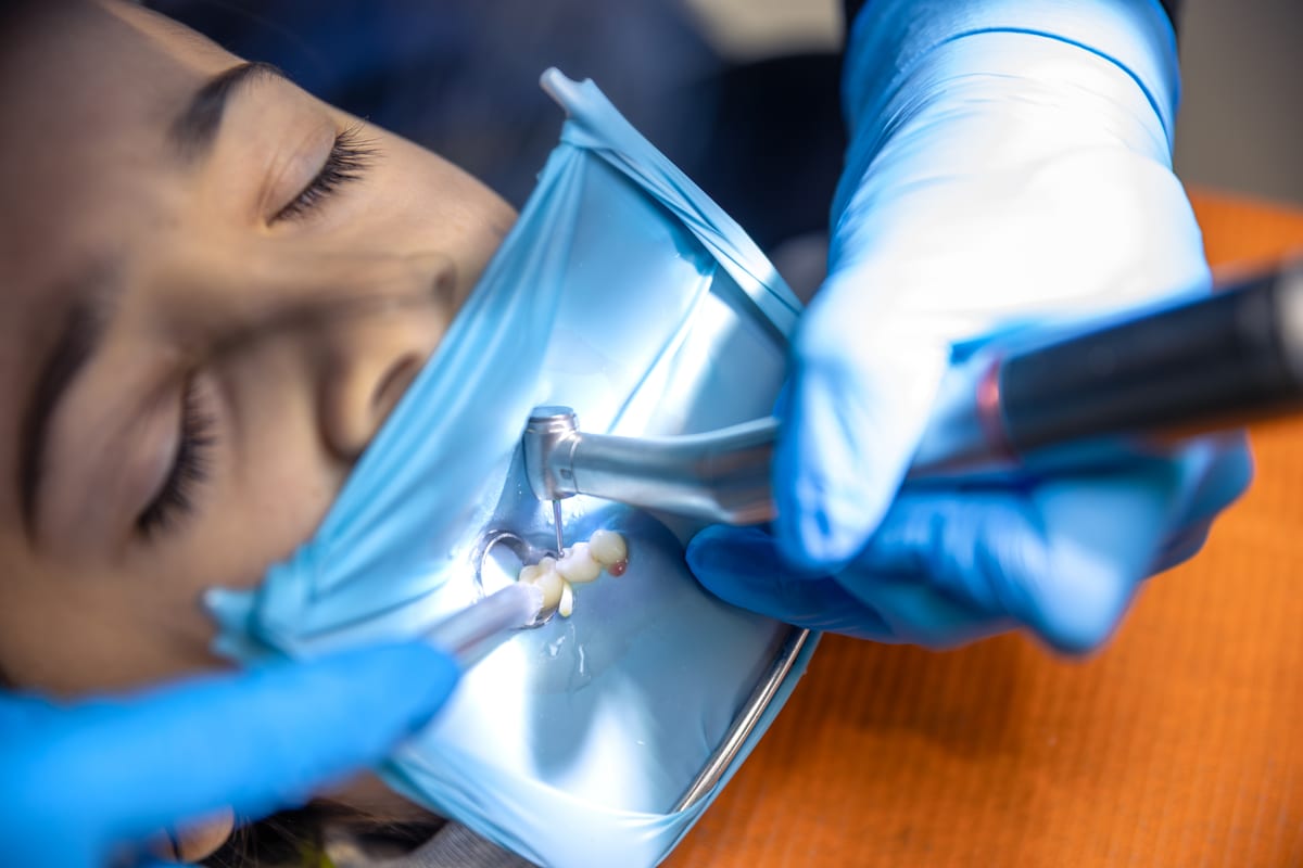 Root Canal Treatment in Phoenix
